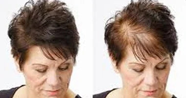 ودّعي تساقط الشعر! علاج طبيعي كامل بشامبو + زيت إكليل الجبل الأصلي 🌿✨ 🇺🇸 Mielle Originale