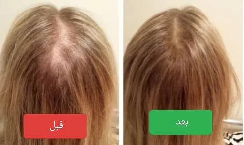 ودّعي تساقط الشعر! علاج طبيعي كامل بشامبو + زيت إكليل الجبل الأصلي 🌿✨ 🇺🇸 Mielle Originale