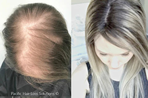 ودّعي تساقط الشعر! علاج طبيعي كامل بشامبو + زيت إكليل الجبل الأصلي 🌿✨ 🇺🇸 Mielle Originale