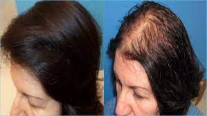 ودّعي تساقط الشعر! علاج طبيعي كامل بشامبو + زيت إكليل الجبل الأصلي 🌿✨ 🇺🇸 Mielle Originale